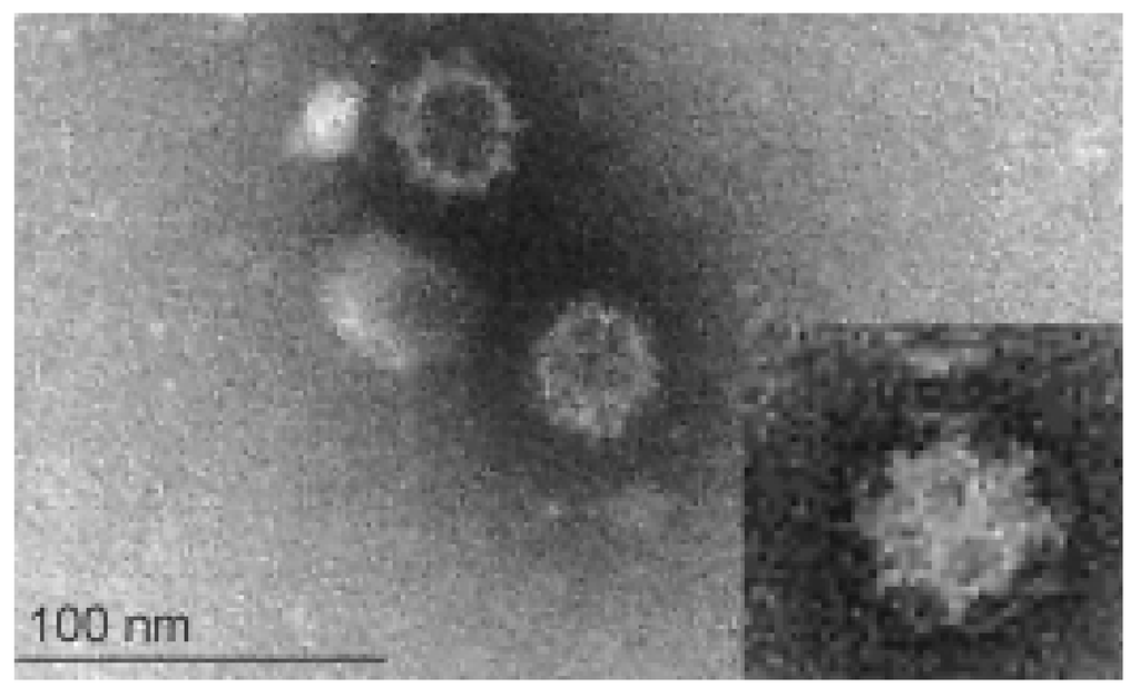 calicivirus felino